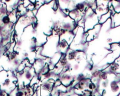 <p>what kind of tissue is being shown in the slide</p>