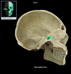 <p>identify the structure:</p>