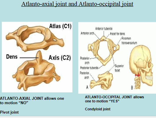 <p>Based on the shape of the articulating surface</p><p></p><ol><li><p>Plane Joint → flat articulating surfaces</p><ul><li><p>Examples: Intercarpals/intertarsals</p></li><li><p>Gliding movements allowed</p></li></ul></li><li><p>Hinge Joint → one articular surface is cylindrical and the other surface is trough</p><ul><li><p>Flexion and Extension allowed</p></li><li><p>Examples: elbow joint, knee joint</p></li></ul></li><li><p>Pivot Joint → one articular surface is round and other surface is a sleeve or ring</p><ul><li><p>Rotation allowed</p></li><li><p>Example: radioulnar joint</p></li><li><p>Atlanto-axial joint = allows us to move the head side to side to motion “NO”</p></li></ul></li><li><p>Condyloid Joint → one articular surface is oval protrusion and the other surface is an oval depression</p><ul><li><p>Flexion, extension, abduction, adduction, and circumduction allowed</p></li><li><p>Examples: metacarpophalangeal joints (knuckles)</p></li><li><p>Atlantooccipital joint → allows us to move head up and down to motion “YES” </p></li></ul></li><li><p>Saddle Joint → one articular bone has both convex and concave surfaces and the other articular bone has concave and convex surfaces (in reverse)</p><ul><li><p>Flexion, extension, abduction, adduction, and circumduction allowed</p></li><li><p>Example: carpometacarpal joint of thumb → only example in human body</p></li></ul></li><li><p>Ball-and-socket Joint → one articular surfae is a spherical head and the other surface is a cuplike socket</p><ul><li><p>All movements allowed</p></li><li><p>Example: shoulder and hip joints</p></li></ul></li></ol><p></p>