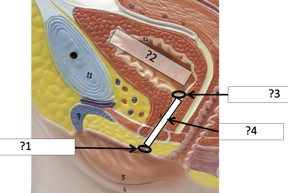 <p>1 Name the hole?</p>