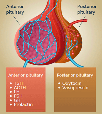 <p><strong>Answer:</strong><br><strong>A) Administer an osmotic laxative</strong>, such as polyethylene glycol.</p><p><strong>Diagnosis:</strong><br><strong>Constipation-associated bladder dysfunction</strong></p><p> Why constipation causes urinary incontinence </p><p>A stool-filled rectum can:</p><ul><li><p>Press against the bladder and reduce its functional capacity</p></li><li><p>Trigger involuntary bladder contractions</p></li><li><p>Interfere with coordinated bladder emptying</p></li></ul><p>This can cause both <strong>daytime accidents and nighttime bed-wetting</strong>. Constipation and daytime urinary symptoms should be treated before starting treatment directed specifically at nocturnal enuresis.</p><p> <br><br>When the other answers would be right <br><br>B) Desmopressin </p><p>Choose this for <strong>monosymptomatic nocturnal enuresis</strong>:</p><ul><li><p>Bed-wetting only</p></li><li><p>No daytime urinary symptoms</p></li><li><p>No untreated constipation</p></li><li><p>Normal urinalysis</p></li></ul><p>It is especially useful when <strong>rapid, short-term dryness</strong> is desired, such as for sleepovers or camp, or when an alarm is impractical. Relapse is common after the medication is stopped.</p><p> </p><p>Remember: </p><p><strong>Desmopressin:</strong> synthetic ADH acting on renal V₂ receptors → increases water reabsorption and decreases nighttime urine production.</p><p><strong>Desmopressin challenge:</strong></p><ul><li><p>Urine concentrates → <strong>central DI (not enough ADH in the posterior pituitary) </strong></p></li><li><p>Urine stays dilute → <strong>nephrogenic DI</strong></p></li><li><p>Urine concentrates with water deprivation alone → <strong>primary polydipsia </strong><br><br><br>C) Bed-wetting alarm </p></li></ul><p>Choose this for a motivated child and family with <strong>persistent monosymptomatic nocturnal enuresis</strong>, especially when long-term improvement is preferred.</p><p>First treat:</p><ul><li><p>Constipation</p></li><li><p>Daytime urinary accidents</p></li><li><p>Urinary tract infection</p></li><li><p>Other underlying conditions</p></li></ul><p>This child is not ready for an alarm yet because he has <strong>daytime wetting and constipation</strong>.</p><p> <br>D) Renal ultrasonography </p><p>Choose imaging when there are clues to structural or neurologic disease, such as:</p><ul><li><p>Recurrent febrile UTIs</p></li><li><p>Abnormal urinalysis</p></li><li><p>Continuous urine leakage</p></li><li><p>Weak or abnormal urinary stream</p></li><li><p>Abnormal genital or neurologic examination</p></li><li><p>Persistent symptoms despite appropriate initial treatment</p></li></ul><p>This child has a normal examination and urinalysis with a clear reversible cause.</p><p> <br>E) Reassurance that this is normal behavior </p><p>Reassurance may be sufficient for a <strong>younger child with occasional isolated nighttime wetting</strong>, no daytime accidents, and no concerning symptoms.</p><p>This patient is 7, has frequent nighttime wetting, worsening <strong>daytime incontinence</strong>, and painful hard stools, so the constipation needs treatment rather than reassurance alone.</p><p><br><strong>Child with daytime and nighttime wetting + hard, painful stools → treat constipation first with an osmotic laxative.</strong></p>