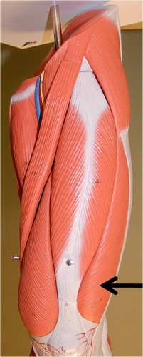 <p>What muscle is this?</p>