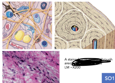 <p>what tissue type</p>