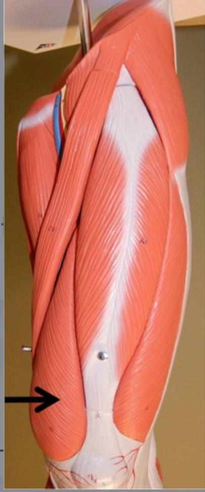 <p>origin: intertrochanteric line insertion:tibial tuberosity (medial condyle)</p>