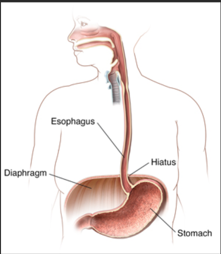 <p><span><strong>an oval opening in the diaphragm that allows the esophagus and associated structures to pass between the thoracic and abdominal cavities.</strong></span></p>