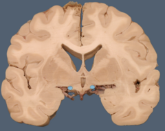 <p>What structure is highlighted blue</p>