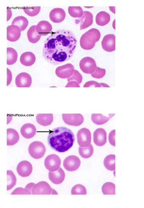 <p>granulation; removed<br><br>susceptibility; albinism; melanin</p>