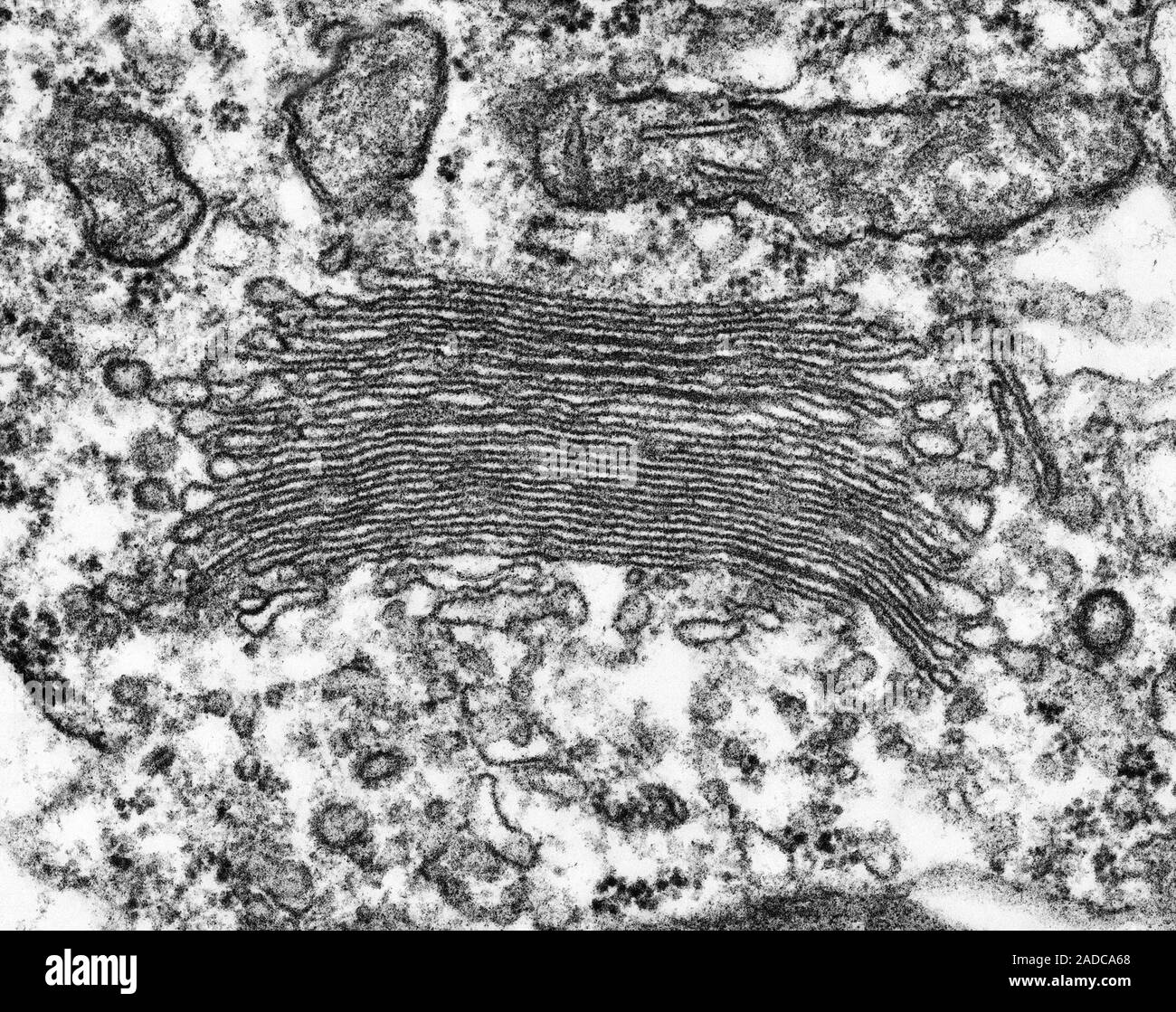 <p>Golgi Apparatus / Golgi Body</p>