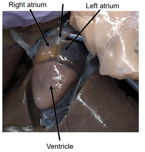 <p>The organ that pumps blood through the circulatory system; three chambers: right atrium, left atrium, and ventricle</p>