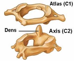<p>the 1st and 2nd cervical vertebra</p>