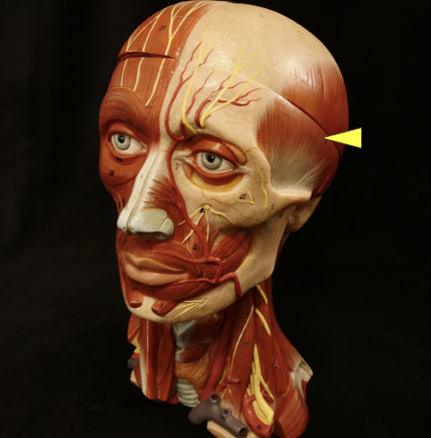 term image