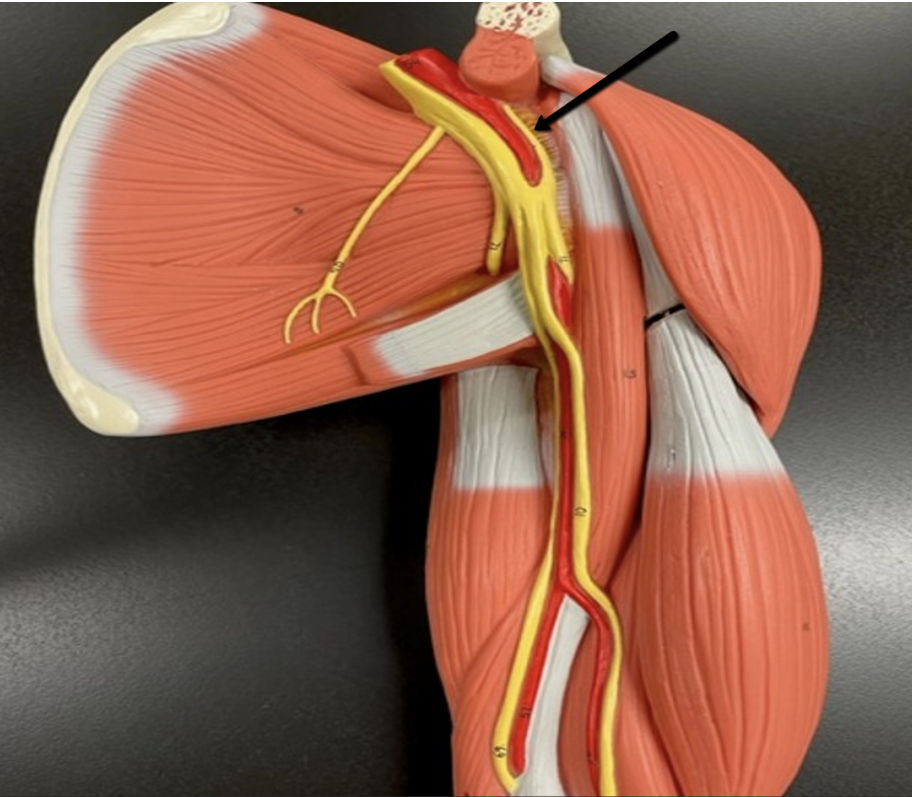 <p><span>Identify the nerve/cord indicated by the pointer.</span></p>