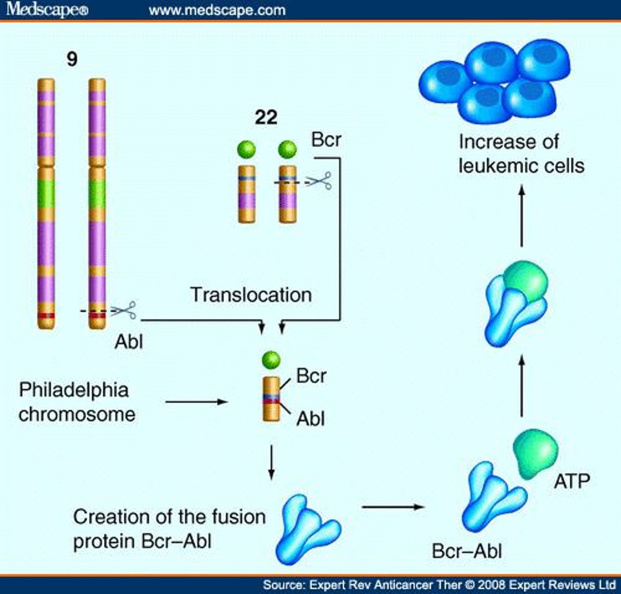 <p>Neoplastic increase in RBCs, WBCs, and platelets, increasing blood viscosity.</p>
