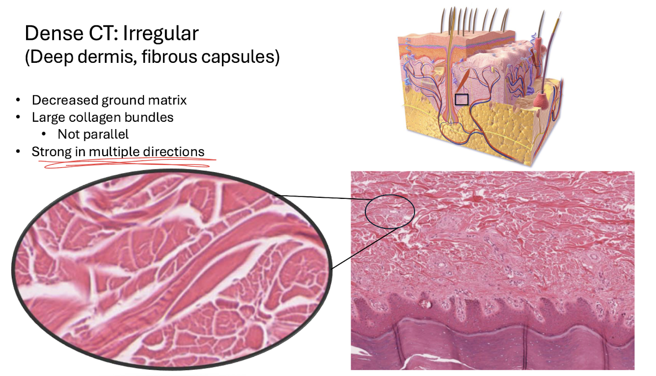 <p><strong>Dense connective tissue proper.</strong></p><ul><li><p>decreased ground matrix</p></li><li><p>Large collagen bundles</p></li><li><p>NOT parallel → strong in multiple direction</p></li></ul><p></p>