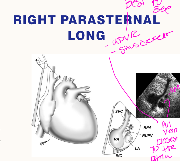 <p>What is the probe indicator direction in right parasternal long?<br>→ 12 o’clock, pt RLD</p><p>What venous flows are evaluated in right parasternal long?<br>→ SVC and IVC flow into the RA</p><p>How are SVC and IVC flow evaluated in right parasternal long?<br>→ Color mapping</p>