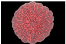 <p><span style="background-color: transparent;"><strong>What is the margin of the following colony?</strong></span></p><p><span style="background-color: transparent;">wrinkled</span></p><p><span style="background-color: transparent;">entire</span></p><p><span style="background-color: transparent;">filamentous</span></p><p><span style="background-color: transparent;">undulate</span></p><p><span style="background-color: transparent;">(Lecture #1-2 Questions)</span></p>