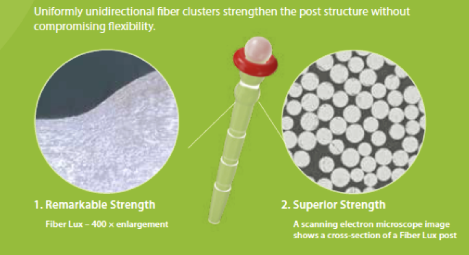 <p>strengthen the post structure without compromising flexibility </p>