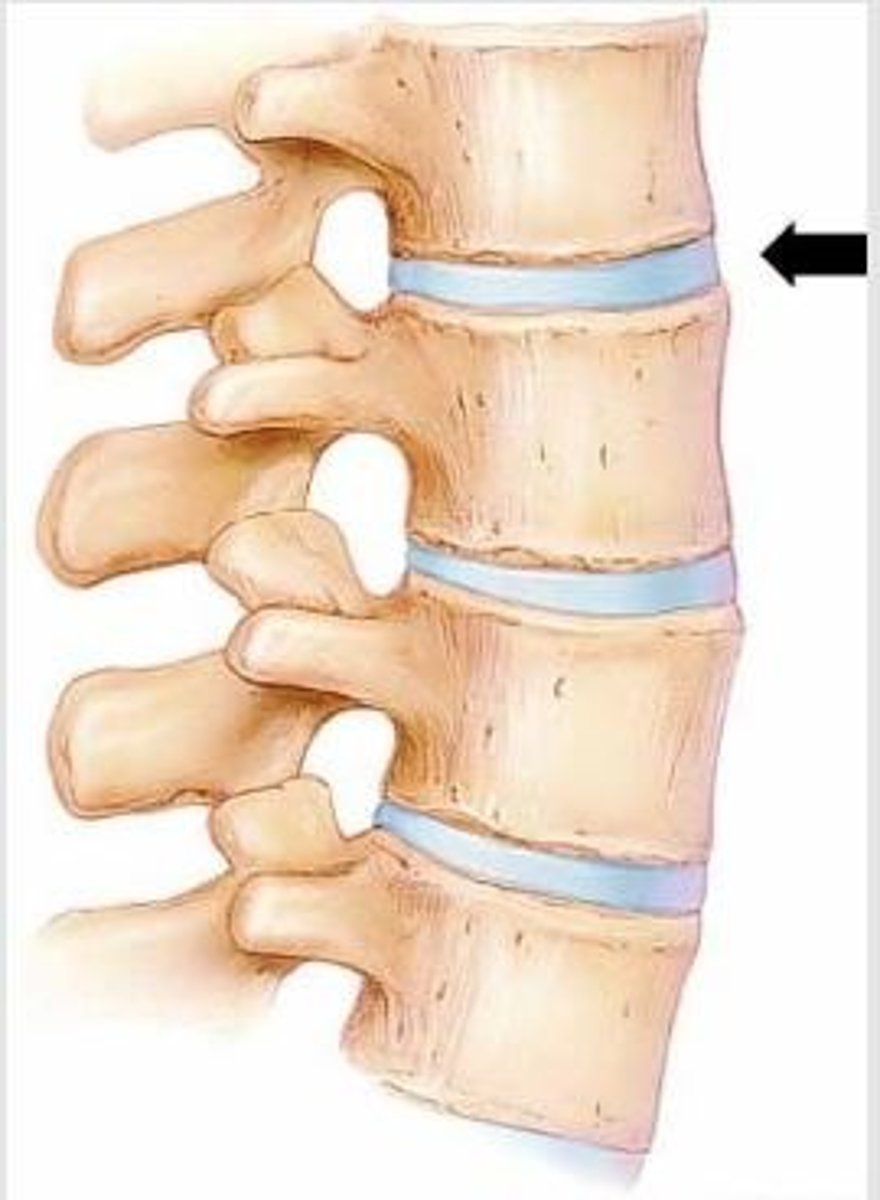 <p>allow only slight movement and consist of bones connected entirely by cartilage, either hyaline or fibrocartilage</p>