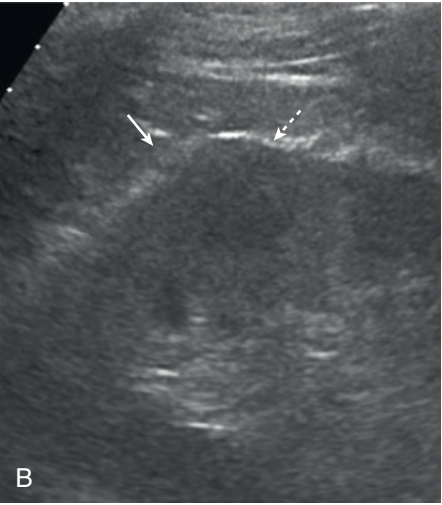 <p>Specific imaging modality used</p>