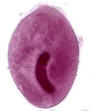 <p><span>55&nbsp;<strong>µm</strong></span></p>