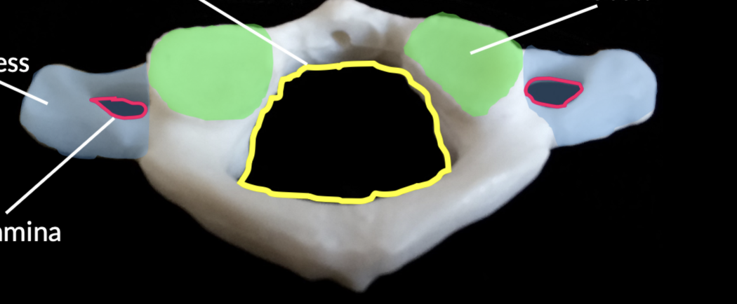 <p>what bone is the yellow line? </p>