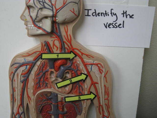 <p>Identify The Vessel 1, 2 and 3?</p><p>Lab Image 3-7</p>