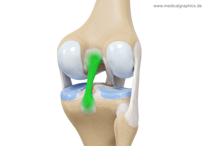 <p>A key ligament in the knee that connects the femur to the tibia, stabilizing the joint and preventing excessive backward movement of the tibia. ON THE POSTERIOR SIDE </p>
