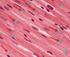 <p>connections between cardiac muscle cells</p>