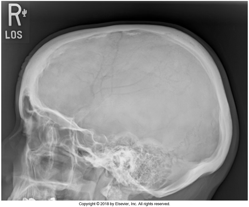 <p>What view is this?</p>