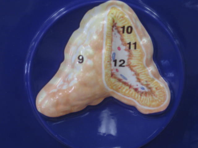 <p>Identify 11 and 12?</p><p>Lab Image 6-7</p>
