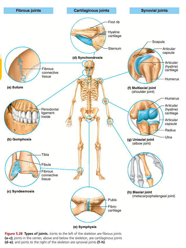<p>Joints are also classified structurally based on what connects the bones:</p><p><strong>Fibrous joints </strong></p><ul><li><p>Bones connected by dense connective tissue</p></li><li><p>Usually <strong>immovable</strong></p></li><li><p>Examples:</p><ul><li><p>Skull sutures (no movement)</p></li><li><p>Gomphoses (teeth in sockets)</p></li><li><p>Syndesmoses (slight movement, e.g., tibia-fibula)</p></li></ul></li></ul><p>These joints prioritize stability over movement.</p><p><strong>Cartilaginous joints </strong></p><ul><li><p>Bones connected by cartilage</p></li><li><p>Allow <strong>limited movement</strong></p></li><li><p>Two types:</p><ul><li><p><strong>Synchondroses</strong> (hyaline cartilage, usually immovable)</p></li><li><p><strong>Symphyses</strong> (fibrocartilage, slightly movable)</p></li></ul></li></ul><p>Examples:</p><ul><li><p>Intervertebral discs (slight movement + shock absorption)</p></li><li><p>Pubic symphysis</p></li></ul><p>These joints balance movement and shock absorption.</p><p><strong>Synovial joints </strong></p><ul><li><p>Bones separated by a fluid-filled cavity</p></li><li><p><strong>Freely movable joints</strong></p></li><li><p>Most joints in limbs are synovial</p></li></ul><p>These are the most important joints for body movement.</p>