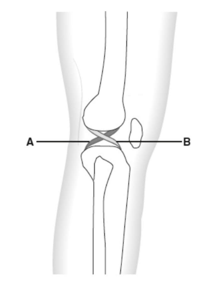 <p>A</p>