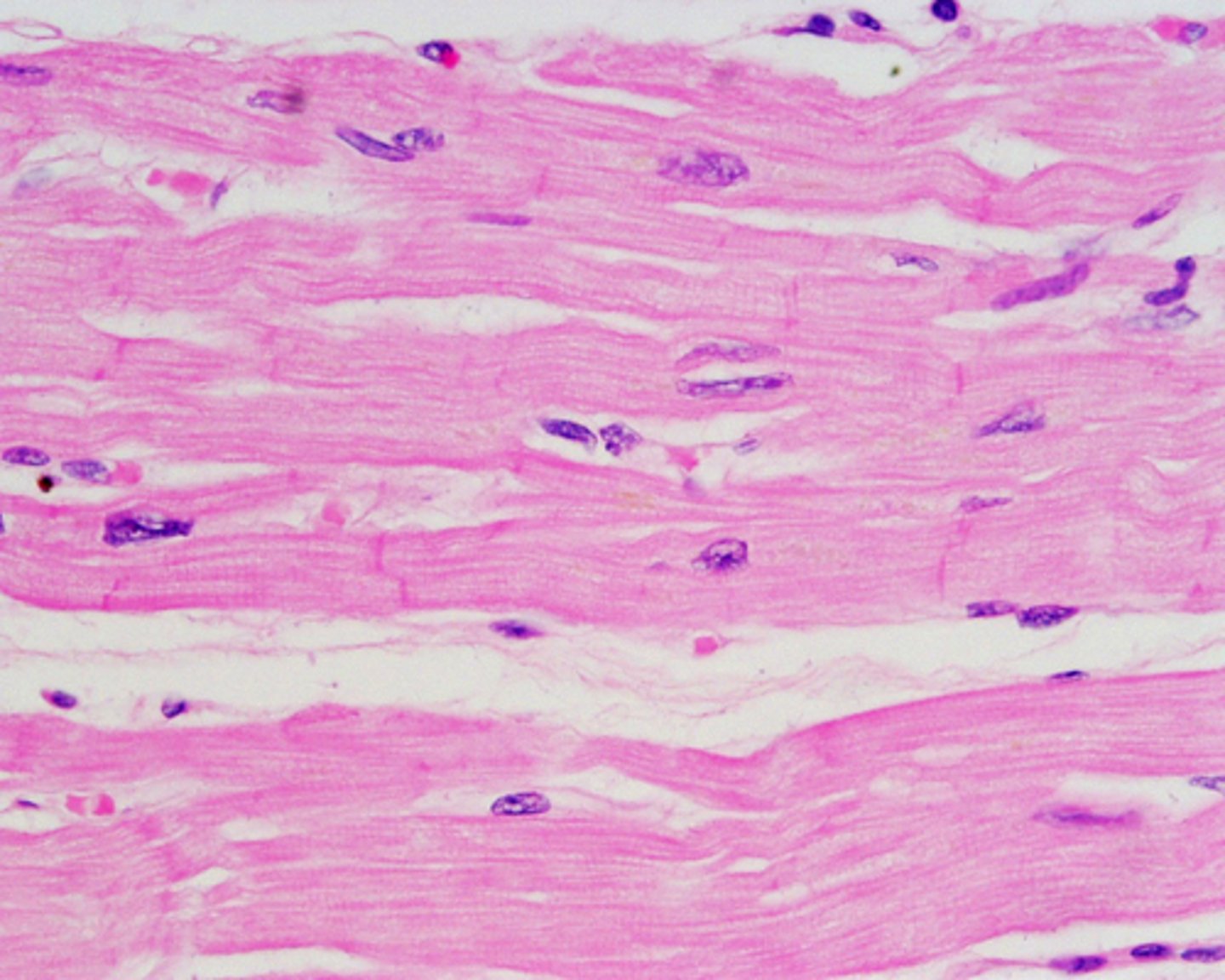 <p>only in the heart, striated muscle cells, involuntary</p><p>relatively short/thick muscle cells that are uninucleate, has intercalated discs containing gap junctions allowing the heart to contract</p>