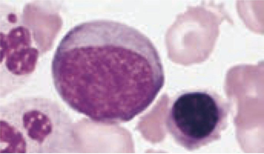 <p>2nd stage of erythrocyte formation</p><ul><li><p><strong>diameter:</strong> 16-18 micrometers (similar to pronormoblast but smaller)</p></li><li><p><strong>nucleus:</strong> 75% of cell</p><ul><li><p>chromatin clumps and becomes coarse</p></li><li><p>heterochromatin is dark violet, euchromatin is lighter → forms a wheel with spokes appearance</p></li></ul></li><li><p><strong>cytoplasm</strong>:</p><ul><li><p>blue with pink, basophilic (higher number of ribosomes/RNA)</p></li><li><p>nucleus is deep purple</p></li></ul></li><li><p>require 20 hrs to develop</p></li></ul><p></p>