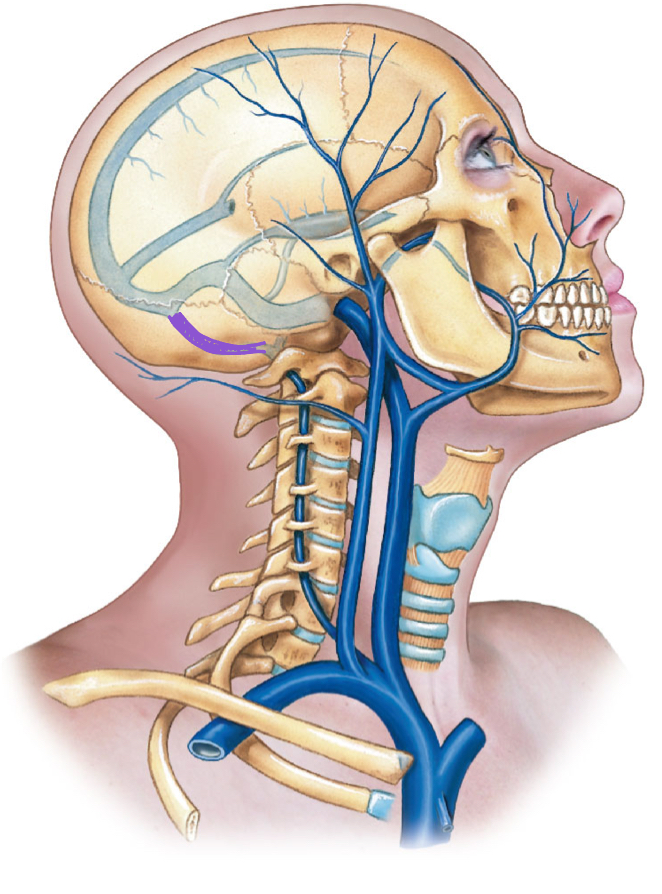 <p>diagram </p>