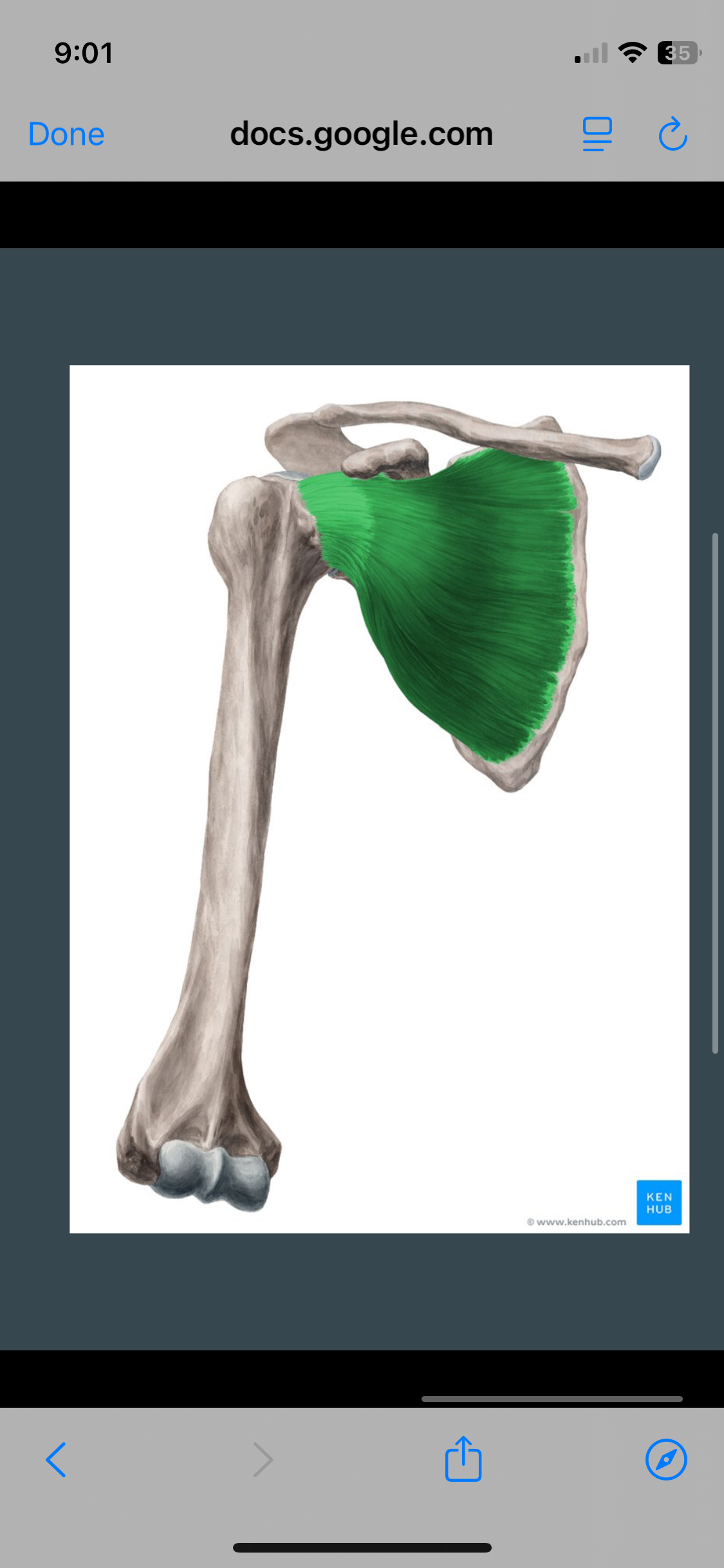 <p>Subscapularis</p>