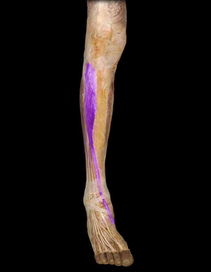 <p>What muscle is this?</p>