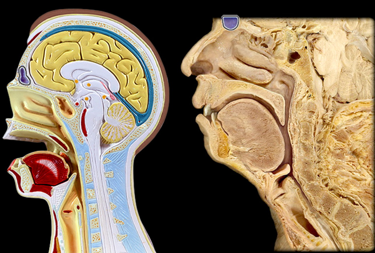 <p>Identify this structure</p>