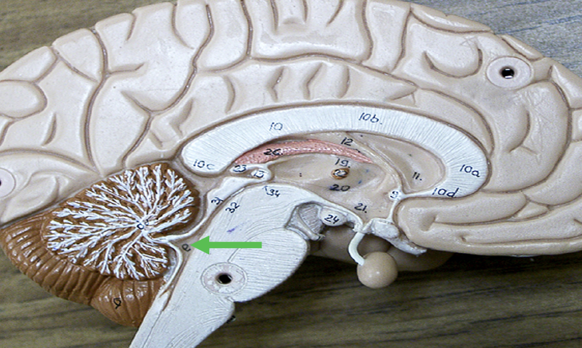 <p>Identify the <strong>space</strong> in the brain indicated by the pointer.</p>