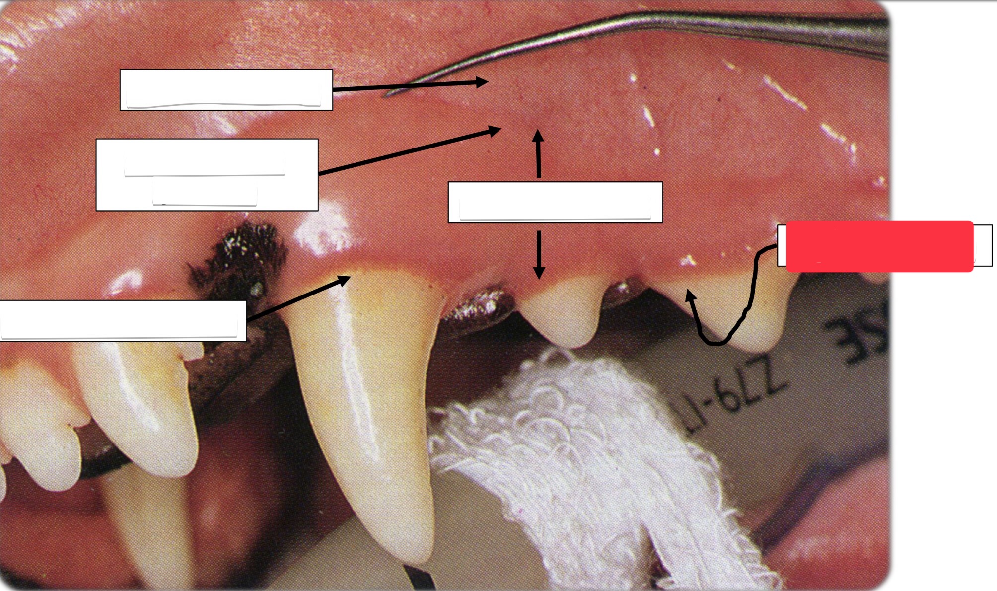<p>Label this part of the gingiva.</p>