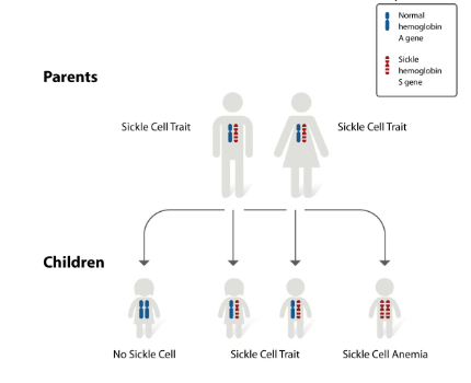 <ul><li><p> Sickle cell anemia – genetic disease caused by variations in the gene for hemoglobin  </p></li><li><p><span style="line-height: 20.925px;">Two alleles for hemoglobin gene&nbsp;</span></p></li></ul><ul><li><p class="Paragraph SCXW193796822 BCX8" style="text-align: left;"><span style="line-height: 20.925px;">Hemoglobin A (HA) - functions normally&nbsp;</span></p></li></ul><ul><li><p class="Paragraph SCXW193796822 BCX8" style="text-align: left;"><span style="line-height: 20.925px;">Hemoglobin S (HS) - forms unusually long chains that distort the shape of red blood cells which forms a curved or sickle shape&nbsp;</span></p></li><li><p class="Paragraph SCXW193796822 BCX8" style="text-align: left;"><span style="line-height: 20.925px;">Three posssible genotypes and phenotypes&nbsp;</span></p></li></ul><ol><li><p class="Paragraph SCXW120341536 BCX8" style="text-align: left;"><span style="line-height: 20.925px;">H<sup>A</sup>H<sup>A</sup> (homozygous dominant) - person ahs normally functiong hemoglobin&nbsp;</span></p></li><li><p class="Paragraph SCXW120341536 BCX8" style="text-align: left;"><span style="line-height: 20.925px;">H<sup>S</sup>H<sup>S</sup> (homozygous recessive) - person has sickle cell anemia&nbsp;</span></p></li><li><p class="Paragraph SCXW120341536 BCX8" style="text-align: left;"><span style="line-height: 20.925px;">H<sup>A</sup>H<sup>S</sup> (heterozygous) – person has a condition called sickle cell trait&nbsp;</span></p></li></ol><ul><li><p><span style="line-height: 20.925px;">The curved blood cells&nbsp;Become trapped in blood vessels which can cause pain and swelling&nbsp;and Are easily destroyed in the blood vessels, causing the person to have fewer rbcs than they need (anemia) and fatigue&nbsp;</span></p></li><li><p><span style="line-height: 20.925px;">In sickle cell trait: The rbc make both types of hemoglobin (a blended trait), Red blood cells will typically function normally and only a few sickle cells are made (normal hemoglobin is dominant), However, an acute attack of symptoms can happen called sickle cell crisis (usually only w/ extreme physical activity under stressful conditions)&nbsp;</span></p></li></ul><p></p>