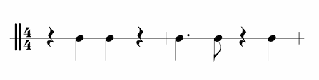 <p>What rhythm pattern is this? </p>