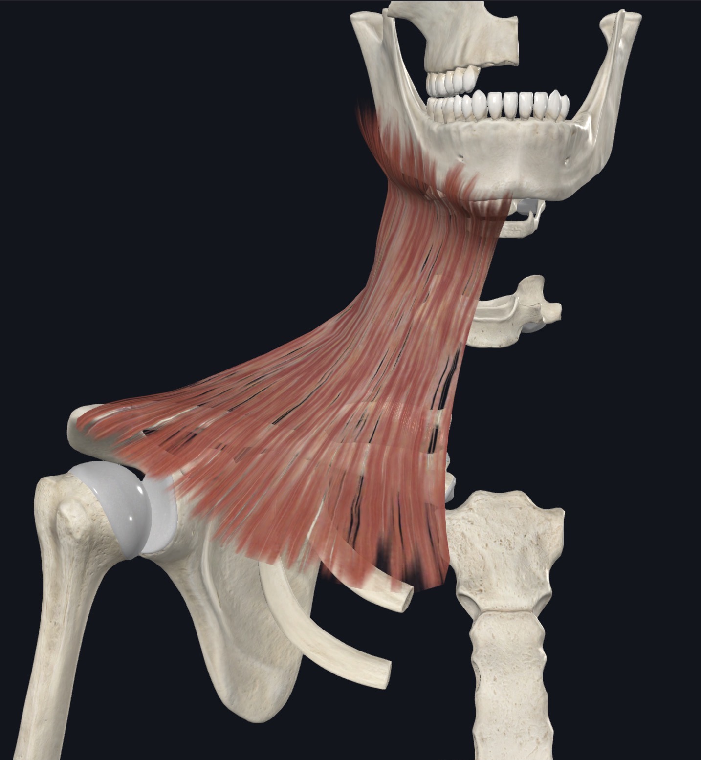 <p>Platysma Superior/Medial attachment</p>