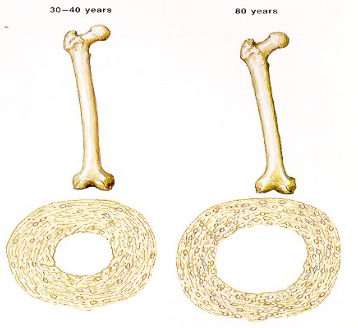 <p>inc; inc; thin </p>