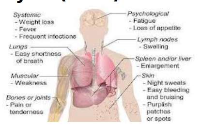 <ul><li><p>Bone marrow cranks out <strong>immature abnormal </strong>leukocytes</p></li><li><p><strong>causes:</strong> Abnormal WBC accumulate (don’t have normal cell cycle) - <strong>become overcrowded</strong></p></li><li><p>Abnormal WBCs <strong>clog</strong> spleen, liver, lymph, bone, etc. Even develop solid masses</p></li><li><p><strong>no single cause: </strong>Can be genetic and environmental radiation, chemicals, viral infxn</p></li></ul><p></p>