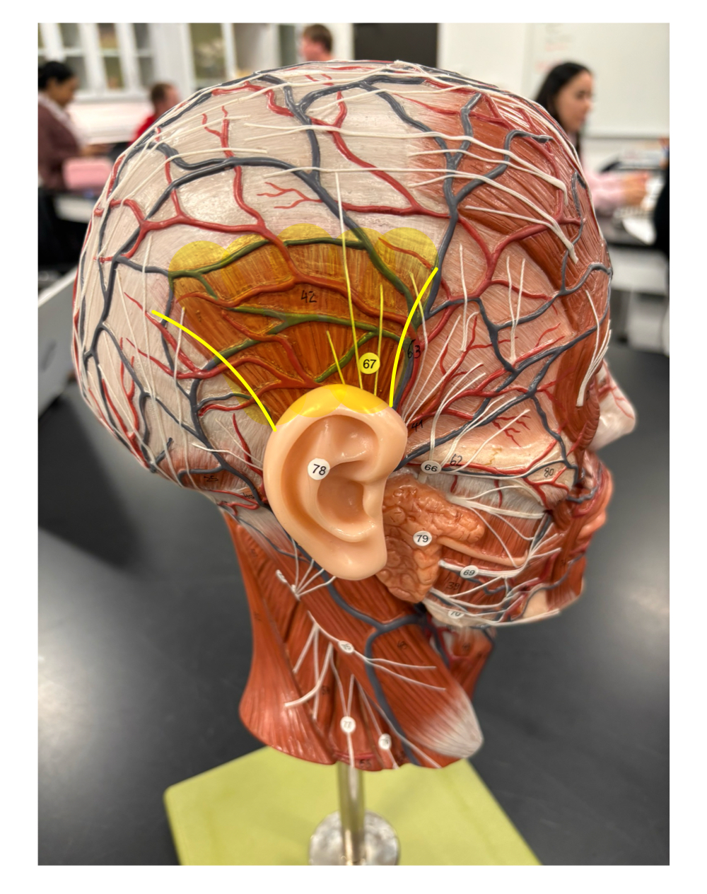 <p>name the muscle and its antagonist</p>