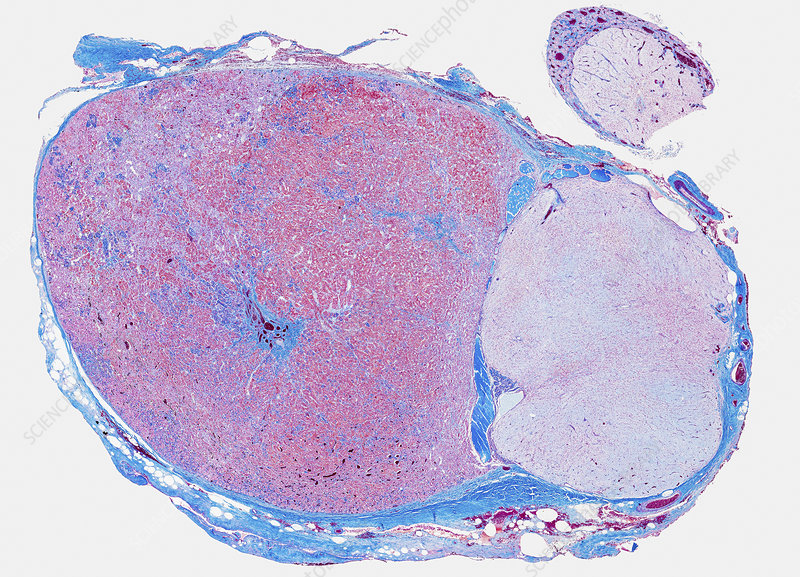 <p>What tissue is this</p>