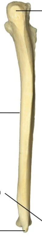 <p>what bone and which way facing</p>