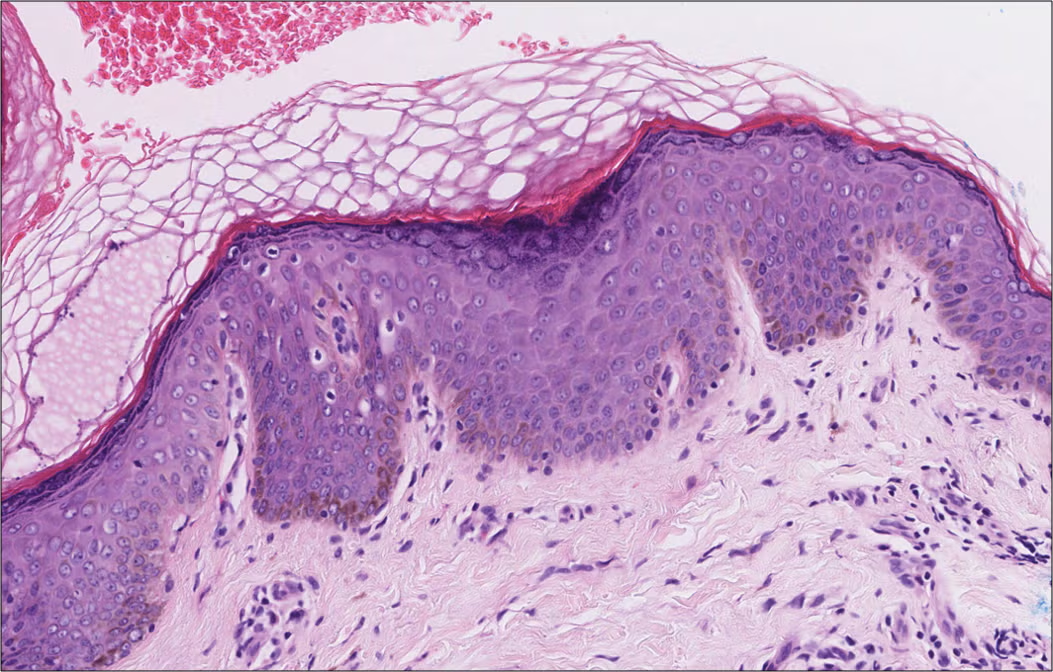 <p>skin</p>