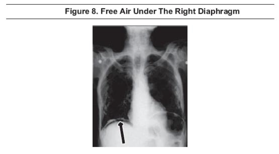 <p>What does this refer to </p>